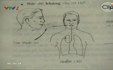 Tìm hiểu về bệnh lao xương khớp